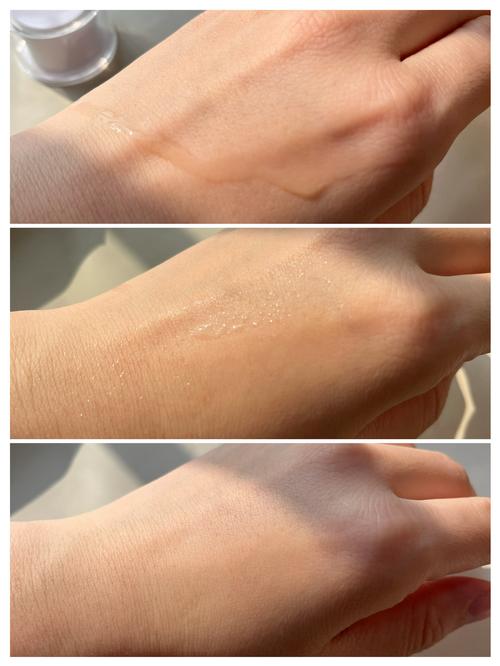 vc粉有祛痘的作用吗-图3