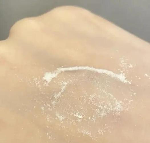 vc粉有祛痘的作用吗-图1