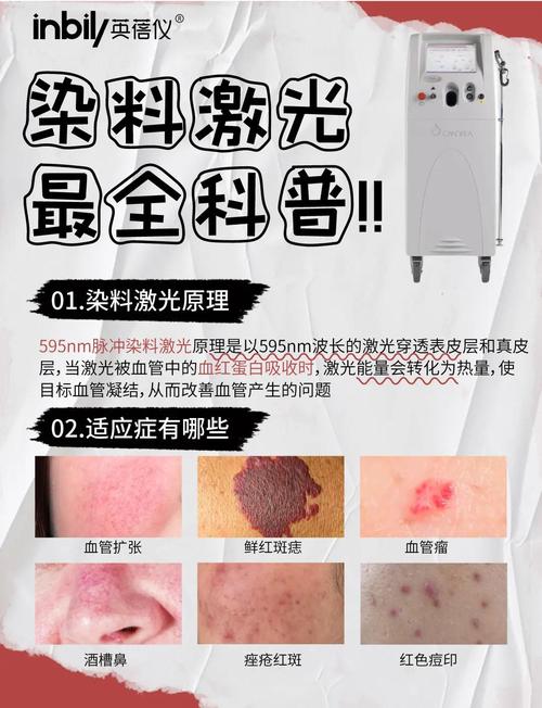 E光祛痘和激光祛痘哪个更好？-图2