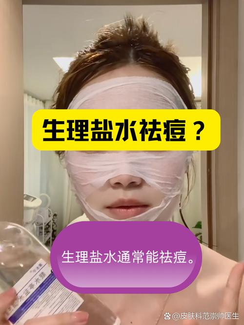 盐水和醋可以祛痘印吗-图1