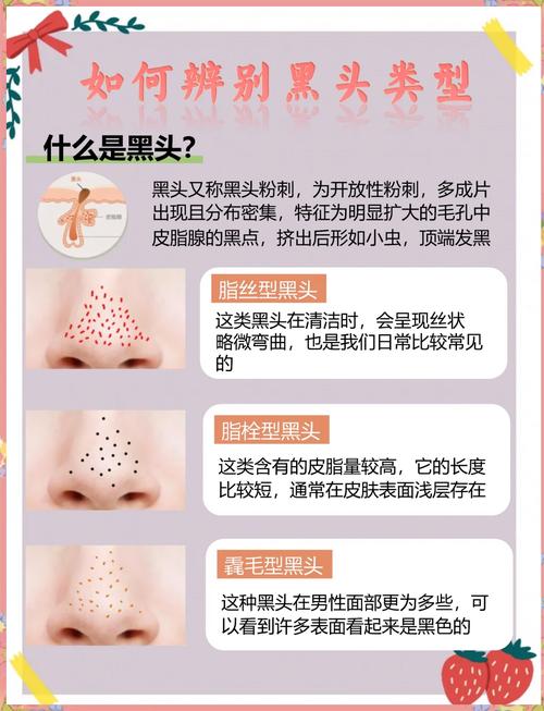 祛痘泥膜天天用会伤肤吗？-图1