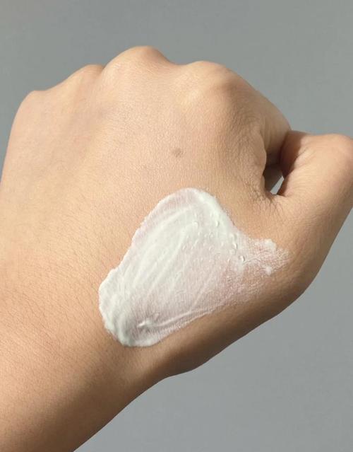 祛痘泥膜天天用会伤肤吗？-图3