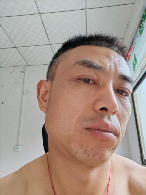 中药膜祛痘印真的有效吗？-图3