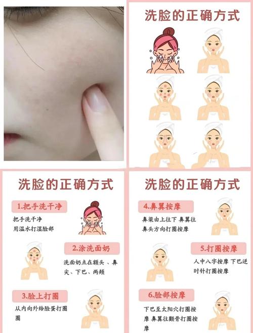 清洁盐水洗脸能祛痘吗？-图2