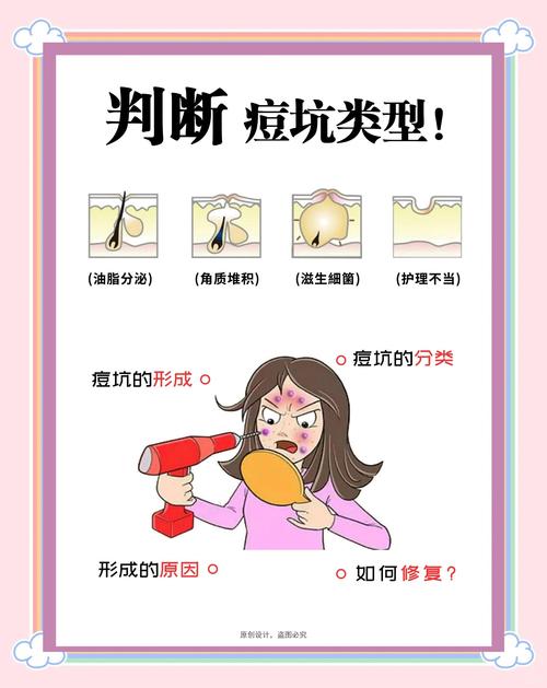 补水和祛痘的那个先做-图2