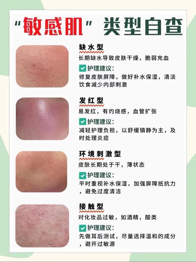 护肤品过敏脸红肿怎么快速缓解？-图2