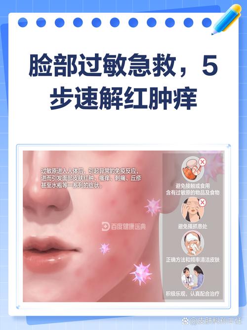 护肤品过敏脸涂了怎么办？-图1