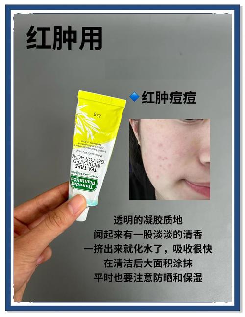 竹炭祛痘膏市场价究竟是多少？-图2