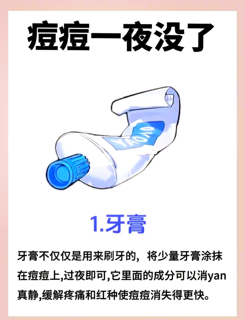 牙膏祛痘靠谱吗？这些注意事项要牢记！-图1