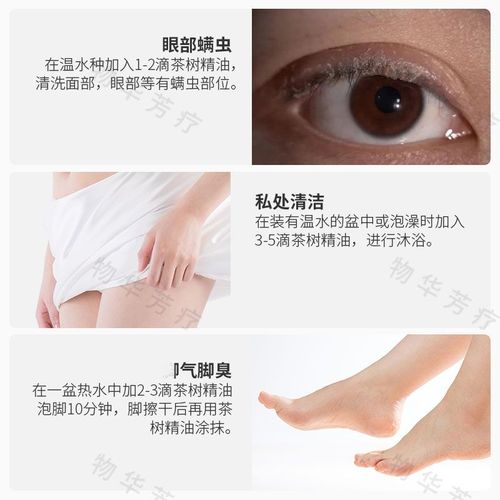 澳洲茶树油祛痘印真的有效吗？-图1