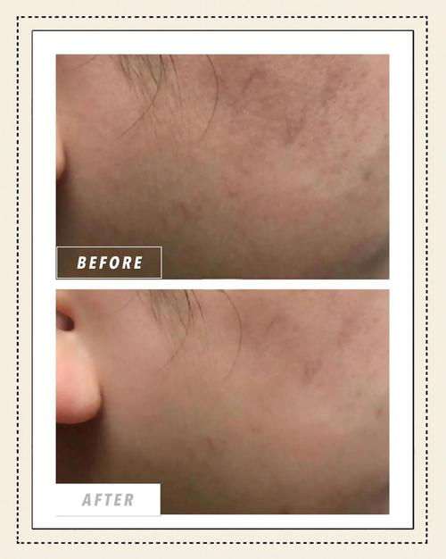 敏感肌孕妇护肤品能用吗？-图2