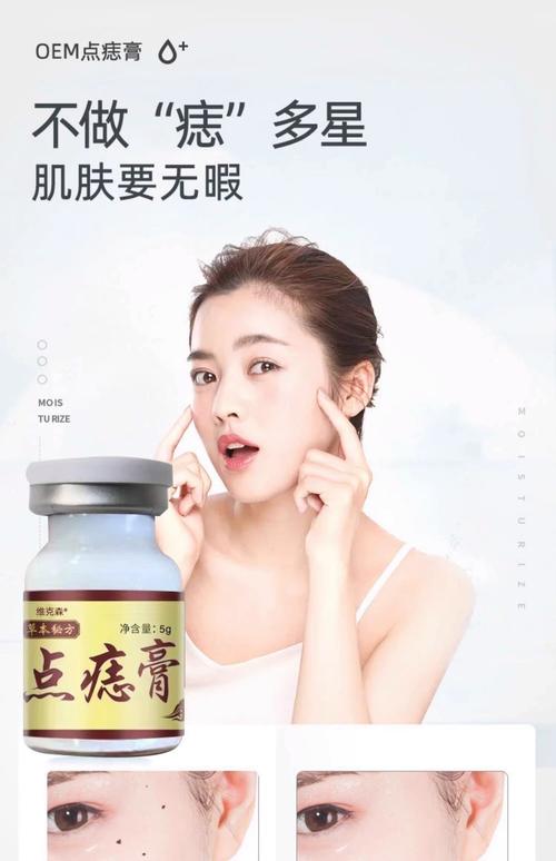 点痣后多久能用护肤品？-图3