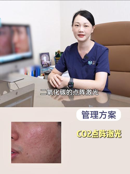 玻尿酸祛痘坑真的有效吗？-图1