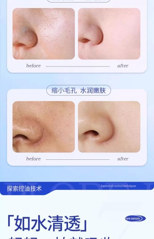 祛痘印收缩毛孔，选哪个产品更好？-图2