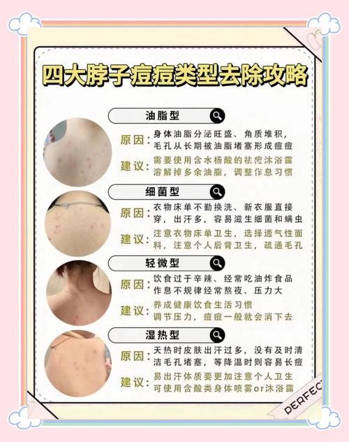 脖子上长痘怎么办？快速祛痘方法有哪些？-图1