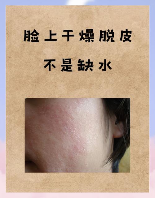 护肤品不吸收？脸该怎么办？-图3