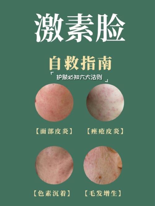 护肤品不吸收？脸该怎么办？-图2