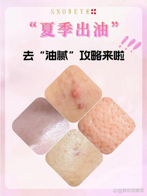 无激素护肤品有哪些品牌推荐？-图3