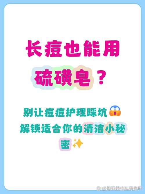 硫磺皂洗脸能祛痘印吗?-图2 硫磺皂洗脸能祛痘印吗?-图2