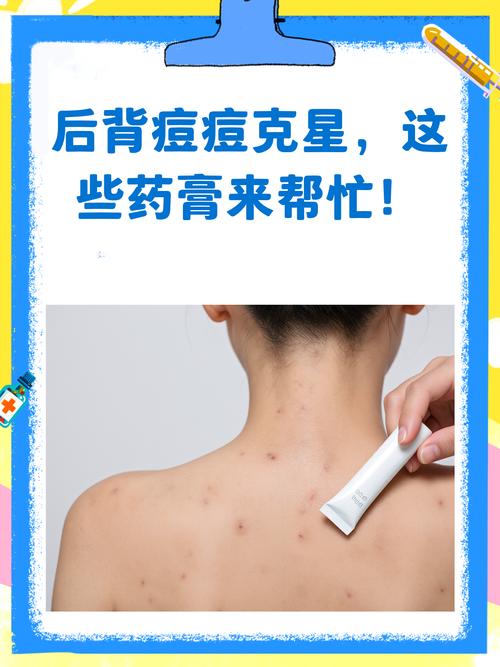 背部祛痘用什么药最管用？-图2
