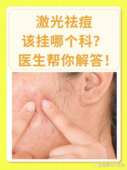 激光祛痘印麻药怎么敷才有效？-图3