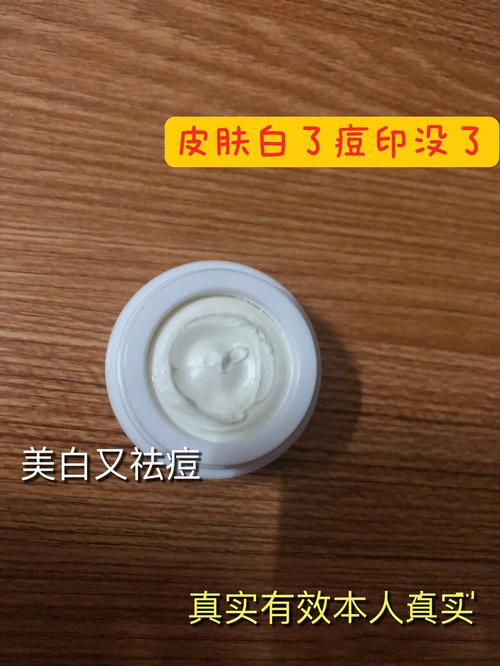 中草药祛痘产品哪些更有效?-图1 中草药祛痘产品哪些更有效?-图1