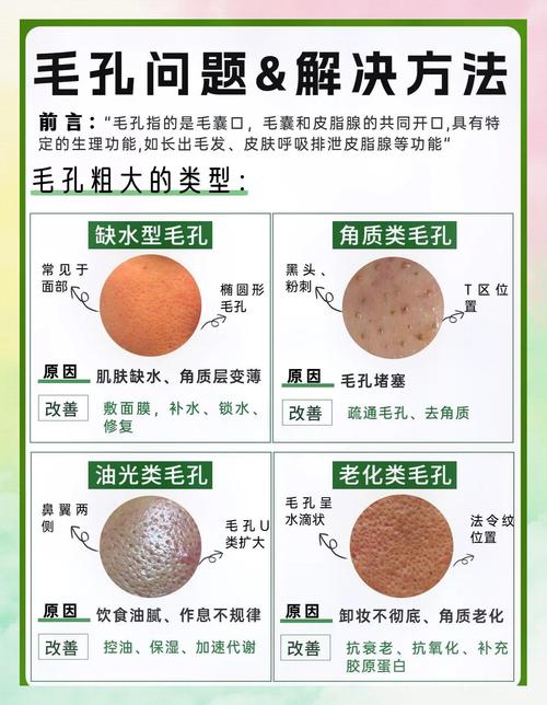 祛痘粉刺毛孔粗大，怎么一起解决？-图1