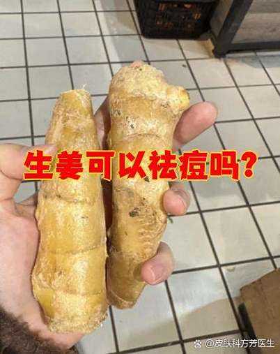 生姜祛痘印到底靠不靠谱？-图1