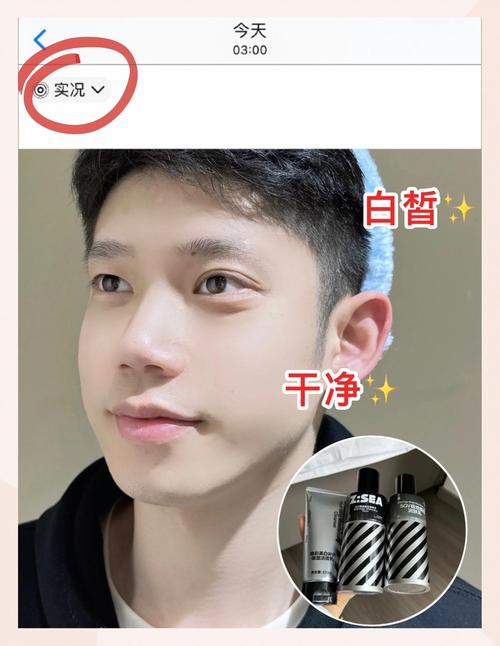 男生如何永久祛痘又美白？-图1