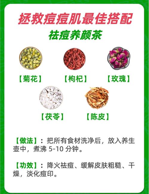 喝中药祛痘全过程要多久？-图1