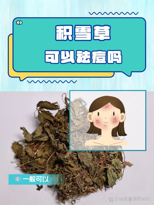 哪种植物祛痘效果最好？-图1