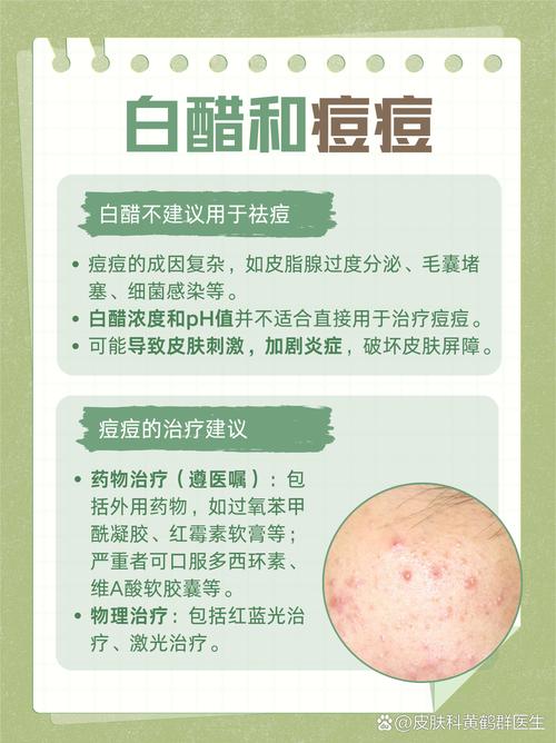 白醋祛痘正确方法是什么？-图1