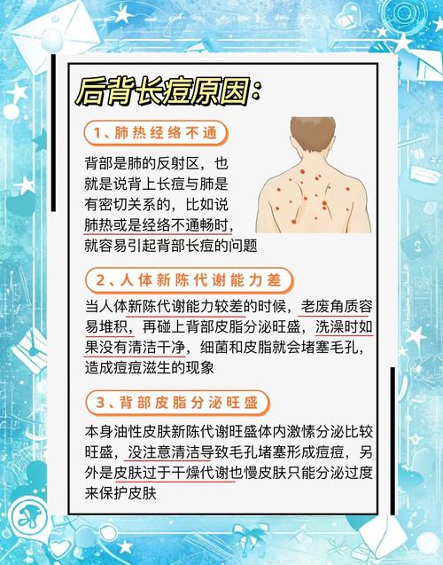 祛痘方法有哪些?健康有效的有哪些?-图3 祛痘方法有哪些?健康有效的有哪些?-图3