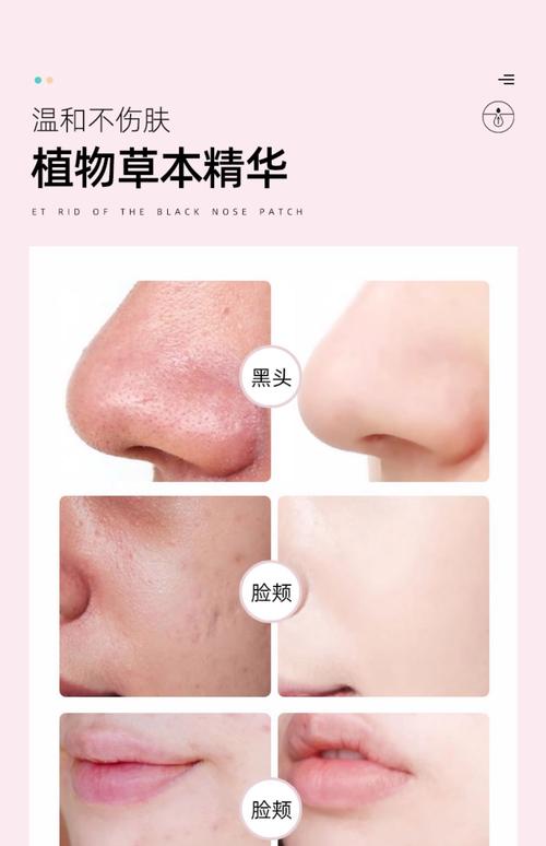 去黑头收缩毛孔，护肤品真的有效吗？-图1