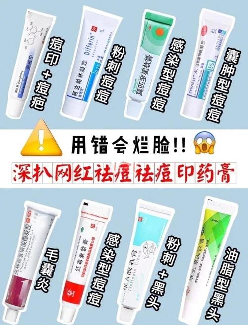 醋涂脸真能祛痘吗？-图2