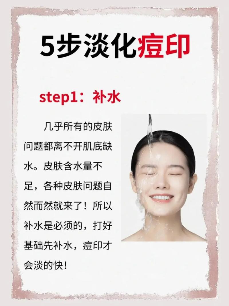 蜂蜜摸脸上可以祛痘吗-图3