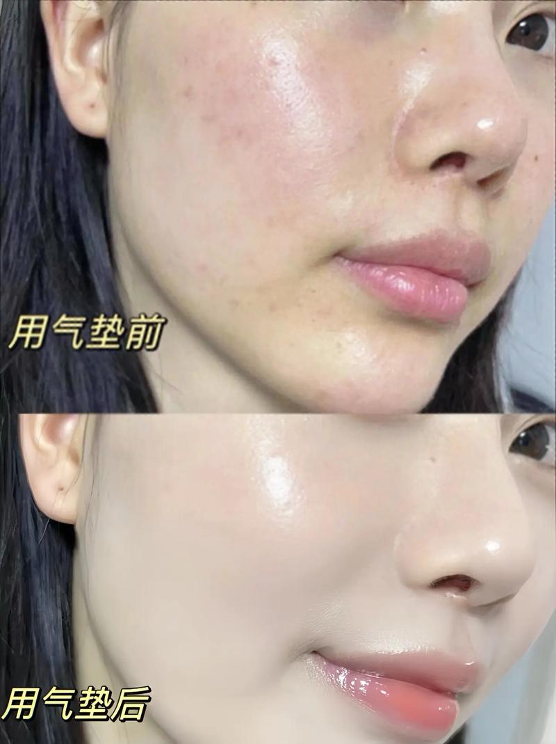 混合皮肤适合什么护肤品-图1