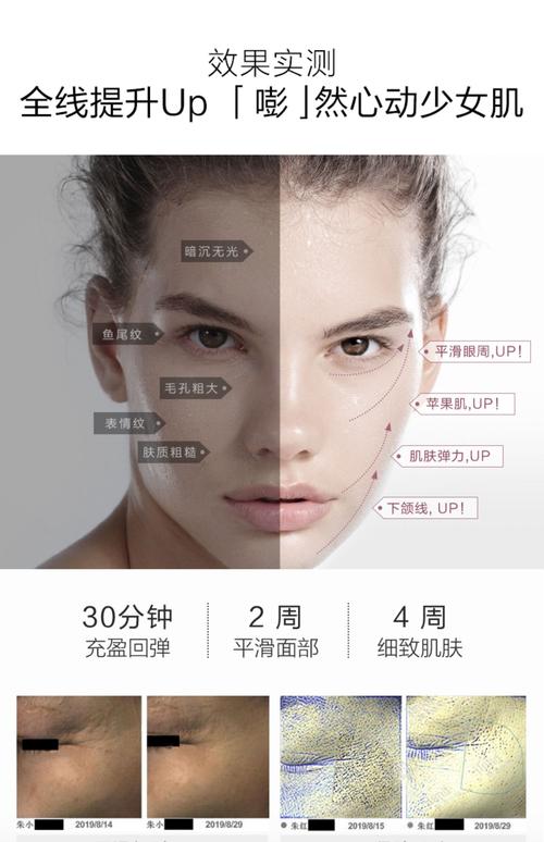 面部填充多久可以护肤-图3 面部填充多久可以护肤-图3
