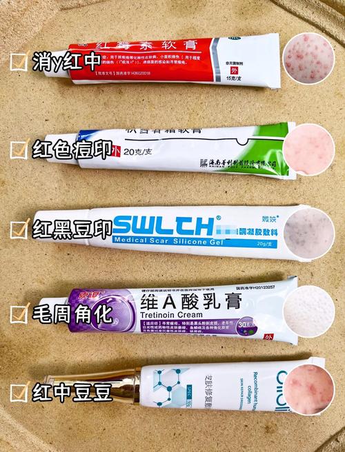 什么产品祛痘印有效果-图3