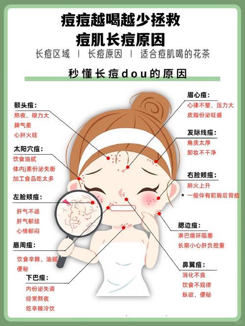 脑门上长痘痘怎么祛痘-图3 脑门上长痘痘怎么祛痘-图3