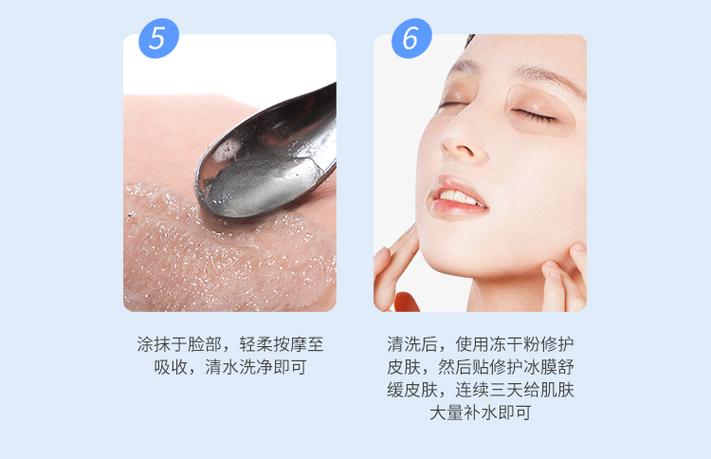 修复冰晶真能祛痘印吗?-图3 修复冰晶真能祛痘印吗?-图3