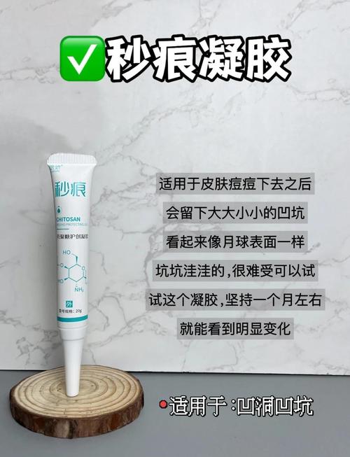 祛痘凝胶白天用可以吗？-图2