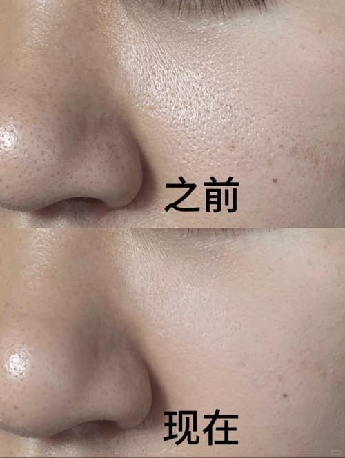 油皮适合什么护肤品？-图2