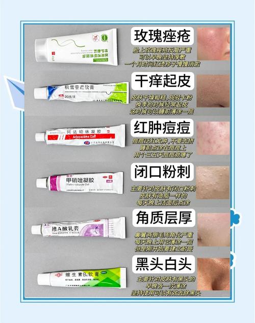 用什么药磨碎洗脸祛痘-图2