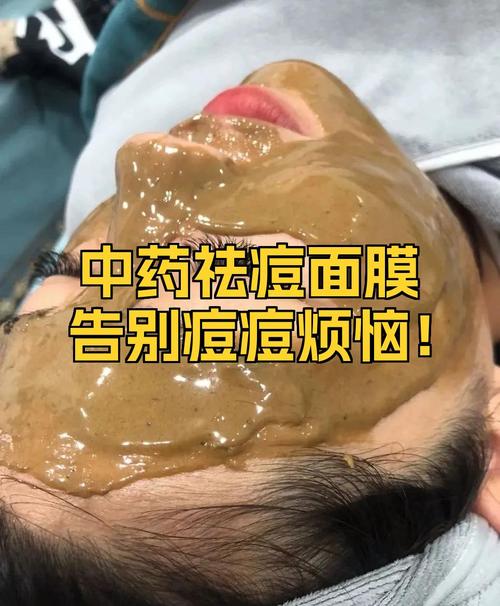 中药祛痘面膜哪里买？-图3