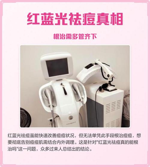 做蓝光可以祛痘成功吗-图2