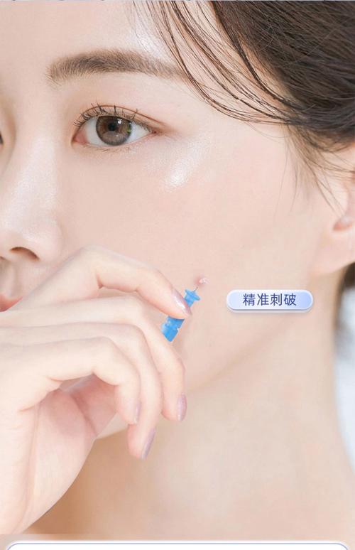 粉刺针消毒就能祛痘?靠谱吗?-图1 粉刺针消毒就能祛痘?靠谱吗?-图1