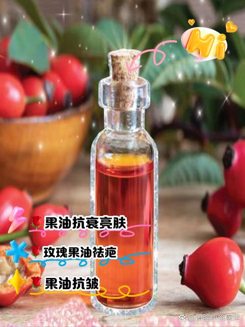 玫瑰果胶囊能祛痘吗?-图2 玫瑰果胶囊能祛痘吗?-图2