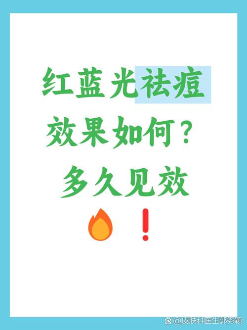 红蓝光祛痘照几次能见效？-图1