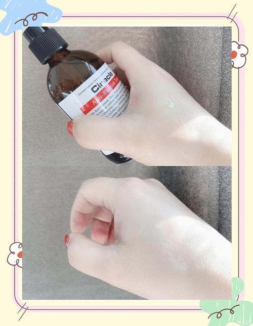 祛痘水和爽肤水，先擦哪个？-图2